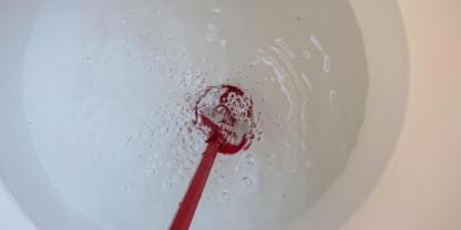 Viele Imker stellen sich die Frage: Zuckerwasser selbst anrühren oder Sirup füttern? Foto: Armin Spürgin
