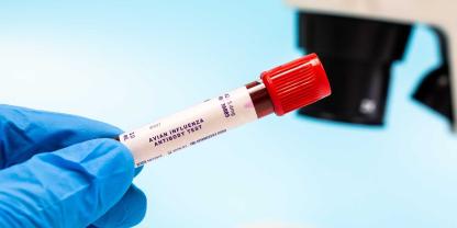 In Europa ist erstmals ein Mensch an der Vogelgrippe-Variante H9N2 erkrankt (Symbolbild).