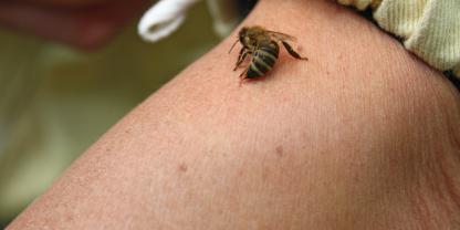 Stiche von Hautflüglern können schwere Reaktionen auslösen. Diese treten bei Honigbienen seltener auf als bei Hornissen.
