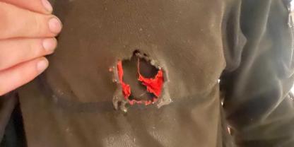 Die Explosion der Patrone hat ein Loch in die Brusttasche des Jägers gerissen.